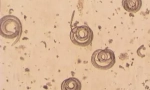 Што е trichinella spiralis