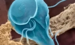 Како да ги помине луѓето во giardia