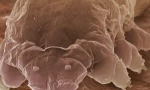 Mite demodex и карактеристики на нејзините средства за живот
