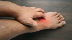 Алергија на каснување на цвет кај човекот