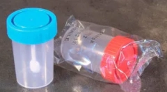 Јајца анализа на јајце