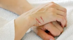 Болести пренесени преку каснувања и гребнатини