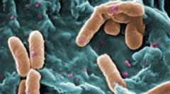 Кои еукариоти се разликуваат од прокариот?