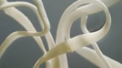 Колку опасни ленти црви кај луѓето и нивните симптоми