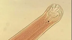 Што е анкилост?