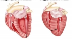 Што е хипертрофична кардиомиопатија во мачки и што е опасно