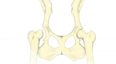 Приказ на колкови зглобови кај кучиња: дијагноза, третман и предвидувања
