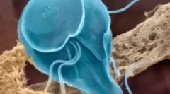 Како да ги помине луѓето во giardia