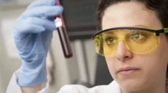 Како крвниот тест се врши на токсоплазмоза