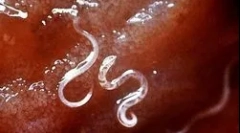 Како маларија плазмодиум живее и се развива