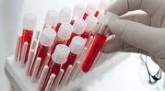 Кои крвни тестови на паразити треба да помине?