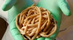 Кои црви живеат во човечкото тело