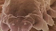 Mite demodex и карактеристики на нејзините средства за живот