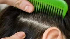 Третман на педикулоза дома