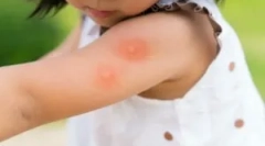 Топ алатки од комарци за деца