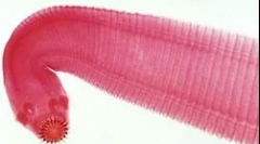 Најчестите видови на црви кај луѓето