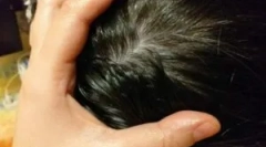 Фолк дома лекови од вошки и gid