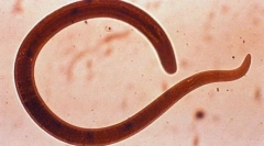 Опасни црви