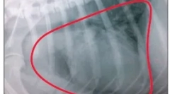 Тумори на белите дробови