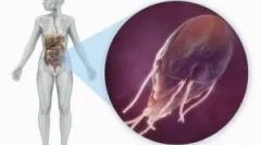 Моќ и исхрана со giardiasis