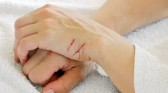 Зошто мачките се борат