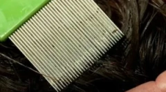 Постапка за завршување за вошки и нд