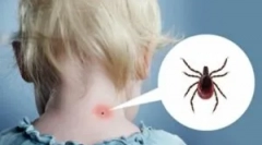 Реакција на телото и штиклирање простор за залак