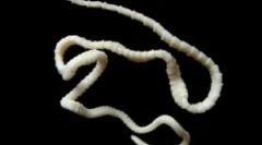 Широк лентц кај луѓето: третман и симптоми