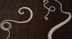 Симптоми и третман на инфекција со моќ