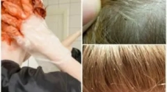 Дали вошката коса боја убива?