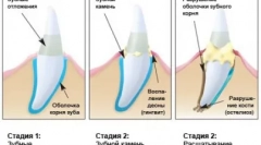 Домашен предаторска нега - чистење на cattick