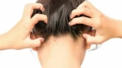 Видови паразитски инсекти во главата на човекот