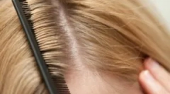 Видови на вошки кај луѓето