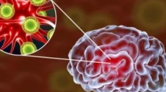 Вирусен енцефалитис на мозокот: видови и симптоми