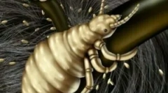 Вошки и нивниот период на инкубација