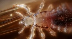 Вошки како носители на болести