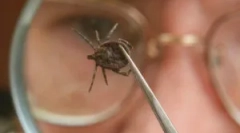 Човек инфекција со енцефалитис предизвикан од ознака